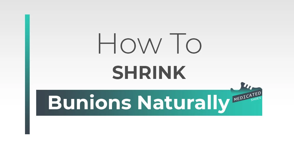 How to Shrink Bunions Naturally