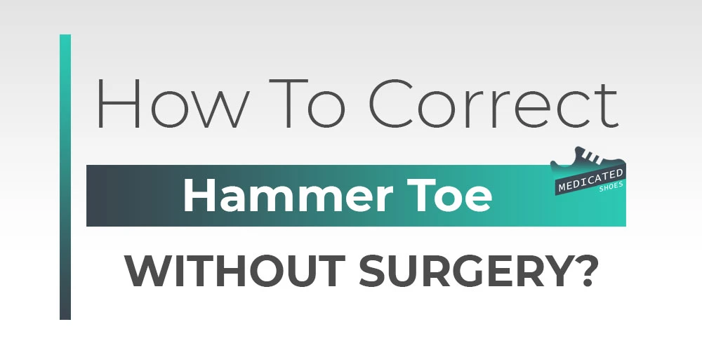 how to correct hammer toe without surgery