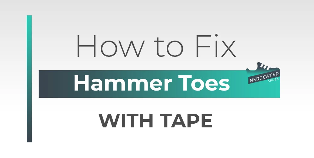 How to Fix Hammer Toes with Tape