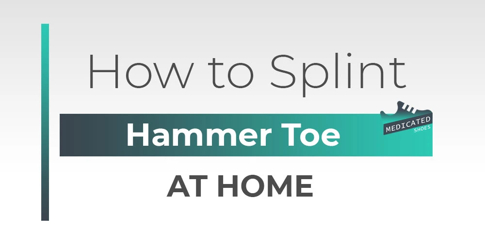 How to Splint a Hammer Toe at Home